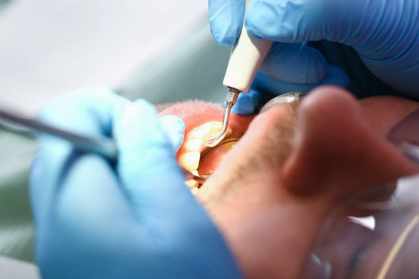 Best Broken Tooth Emergency  in Stone Ridge, VA