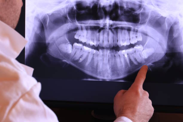 Best Knocked-Out Tooth Emergency  in Stone Ridge, VA